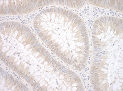 ETS1 associated protein II Antibody, Novus Biologicals 0.1mL; Unlabeled:Antibodies,